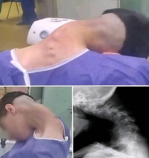 Young man hospitalized because he dropped his ca…See more