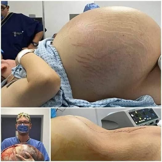 A Rare Birth Case That Astonished Medical Professionals