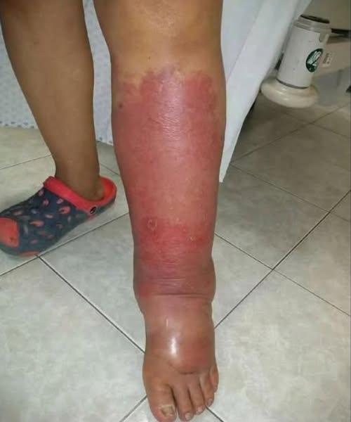 What Your Feet Can Tell You About Your Health