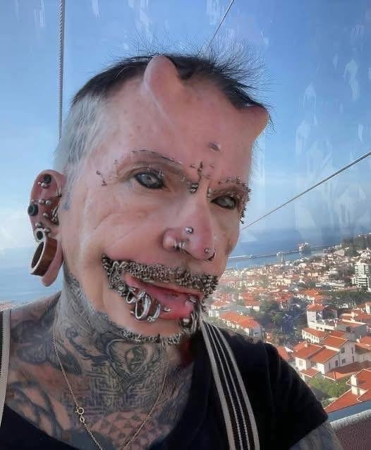 The Extraordinary Transformation of Rolf Buchholz: From Office Worker to the World’s Most Modified Man