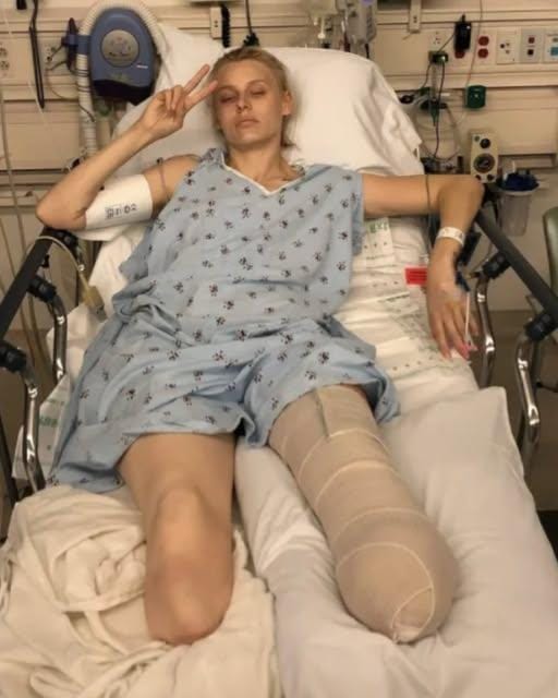 Woman loses her legs due to common household product, now she’s warning women everywhere – check comments 😭👇🏻