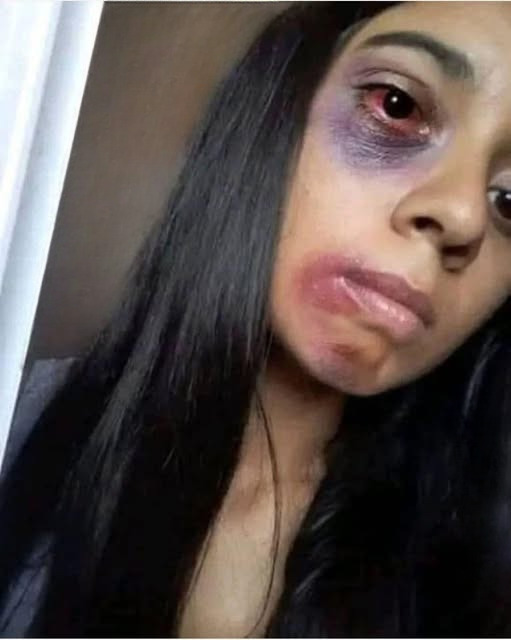 Rest In Peace, Young woman dies in the hands of her?