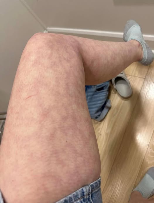 These are the consequences
