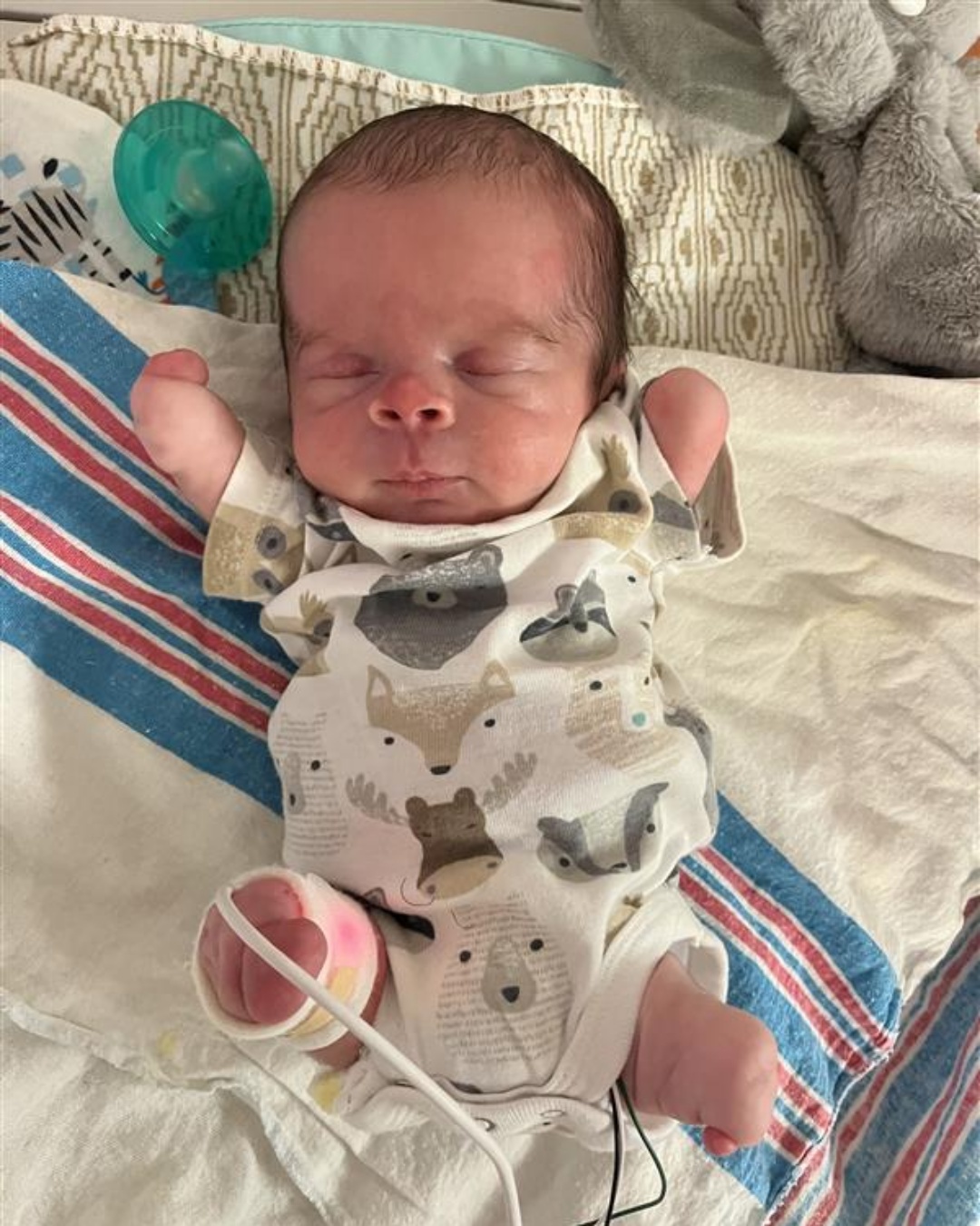 “Against All Odds: Baby Bryson Thrives Without Arms or Legs”.