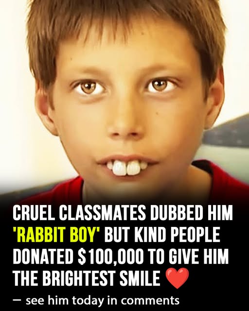 His classmates called him “rabbit boy” – now he has the perfect smile