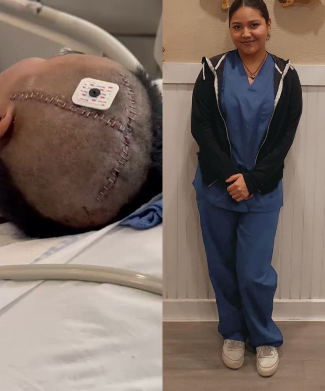 Daisy, 23: A Brain Aneurysm and 13 Surgeries in One Month.