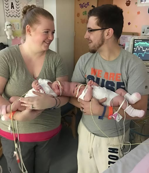 Siamese twins were separated a year after birth: this is how they look seven years later