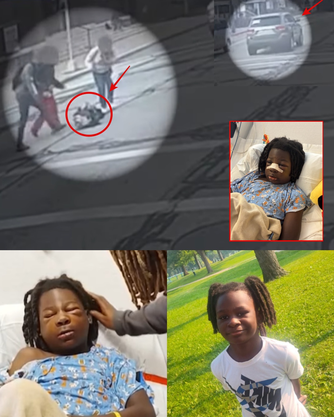 Caught on Camera: The Hit-and-Run No One Wants to Confront.