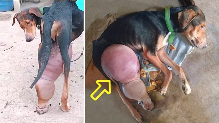 “Please I’m Suffering”, He Collapsed With That Giant Leg & Cried—Every Step is a Cry From Pain