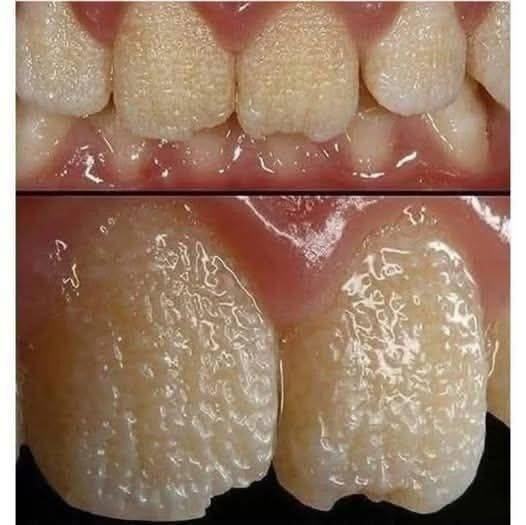 Be careful!! This is what your teeth will become when you eat…