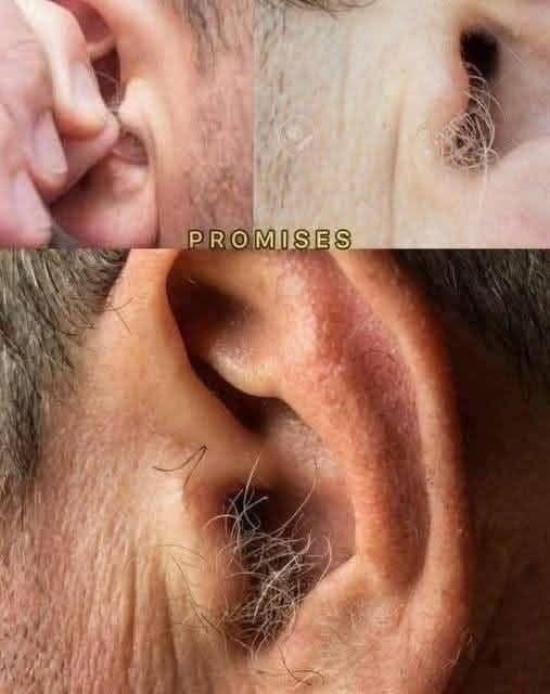 Why Do Humans Have Ear Hair? Understanding Causes and Care