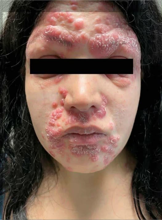 These are the consequences of sleeping co… See more