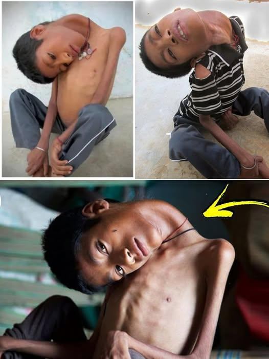 The Boy Who Defied Every Expectation: A Story Doctors Never Forgot When this young boy walked into the small clinic, everyone froze — his posture…………