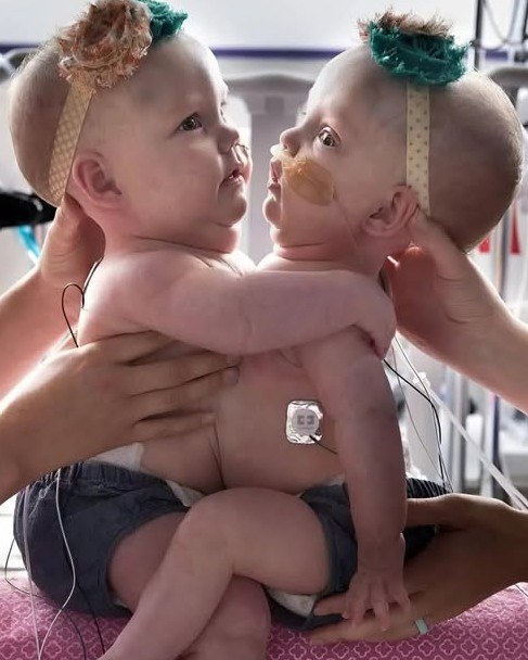 Separated After a Year of Struggle