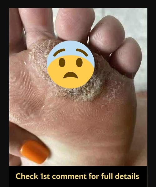 BE VERY CAREFUL . If you get this, you are infected with …. See more