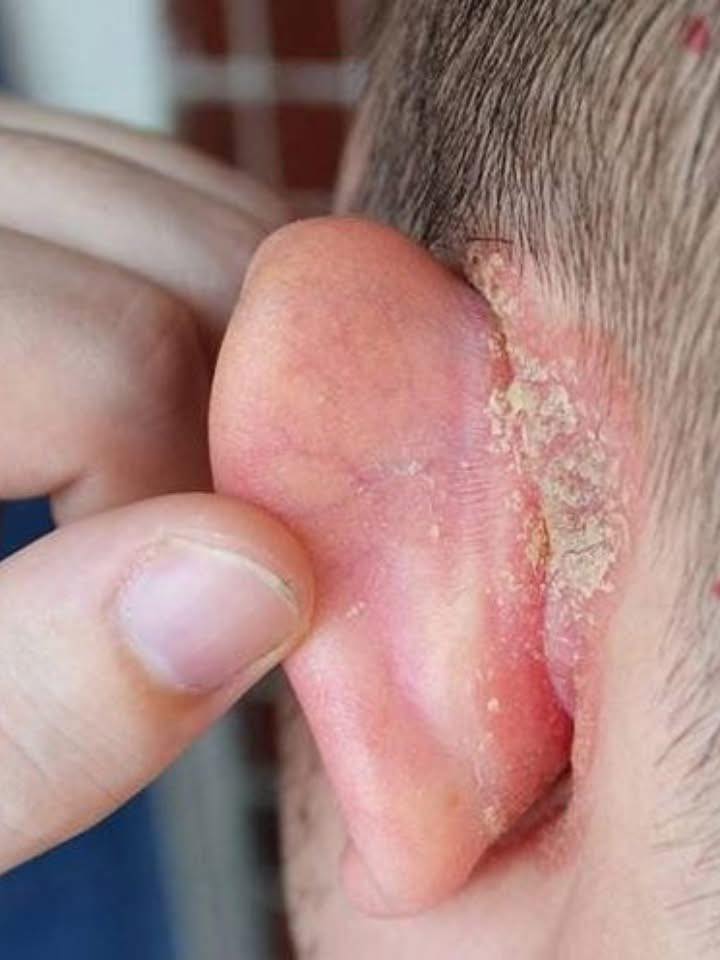 I found a strange patch of skin on my son’s ear this morning. His doctor appointment is a week away — what should I do meanwhile? Full article