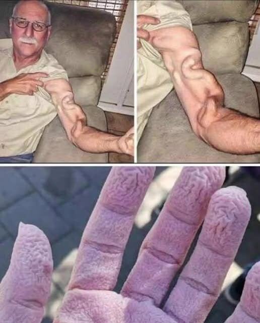 A man goes to stretch and ends up feeling a sharp pain in his arm, it was a ca…