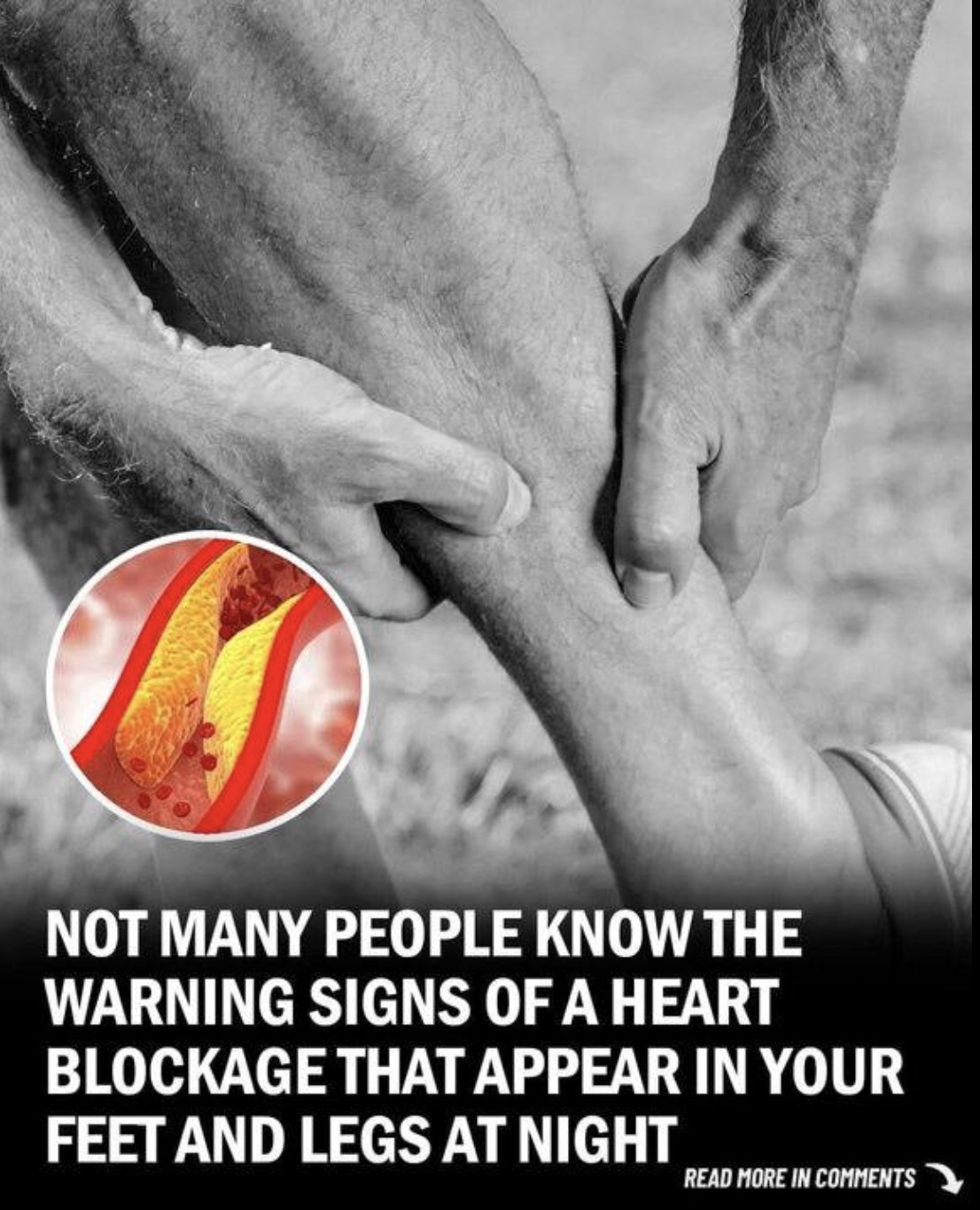 Your feet can warn you about clogged arteries and heart disease