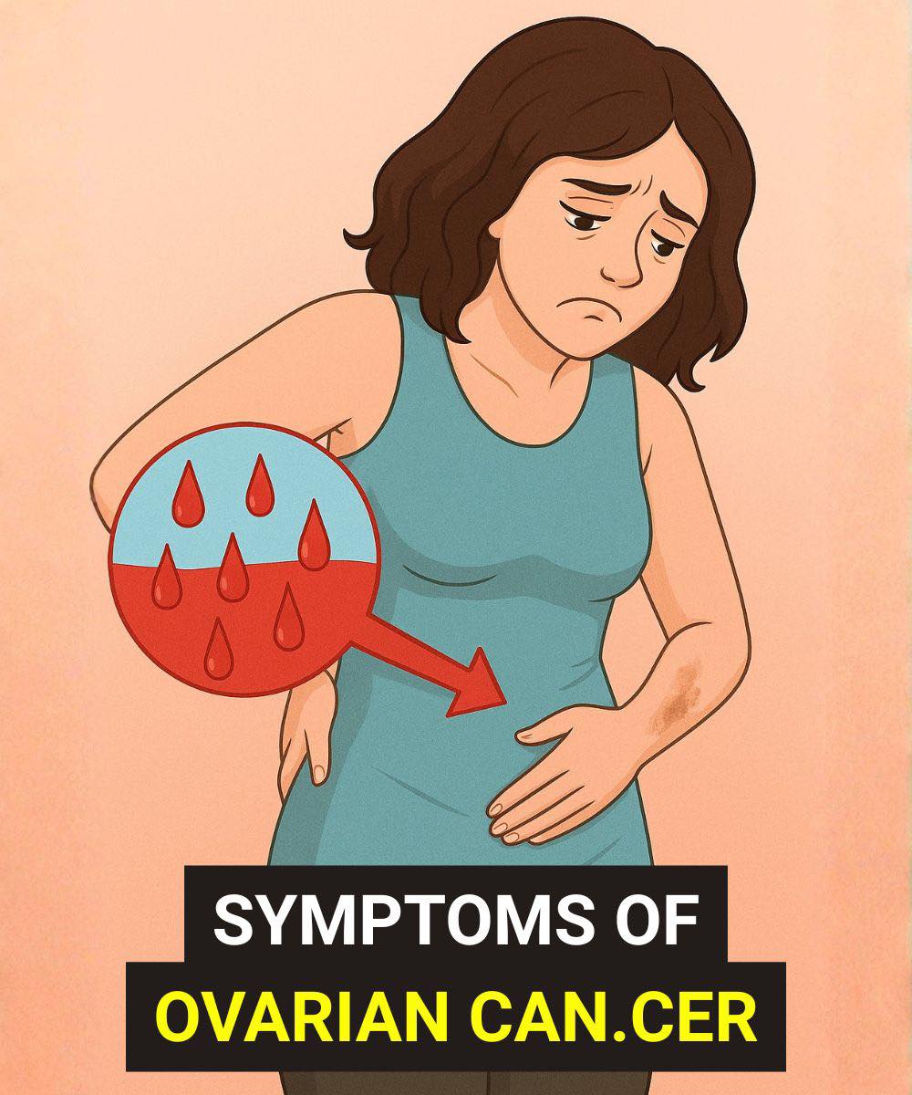 Silent Symptoms of Ovarian Canc3r That Can Appear Years Before Diagnosis