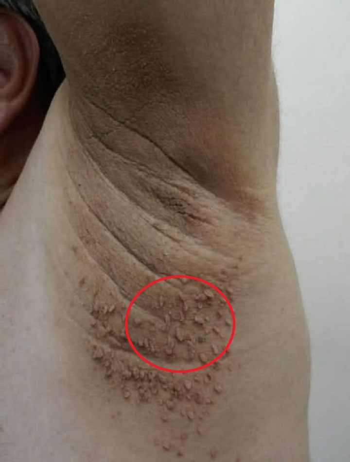 These are the first symptoms of cr…See more