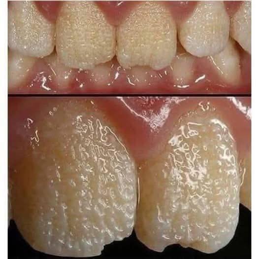 Be careful!! This is what your teeth will become when you eat…