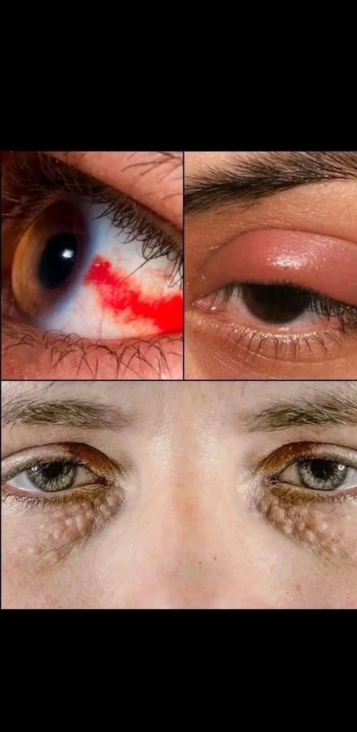 😱 BEWARE! Signs in your Eyes that indicate he is cr…