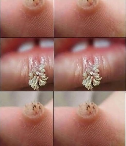 BE VERY CAREFUL 🚨. If you get this, you are infected with…See more