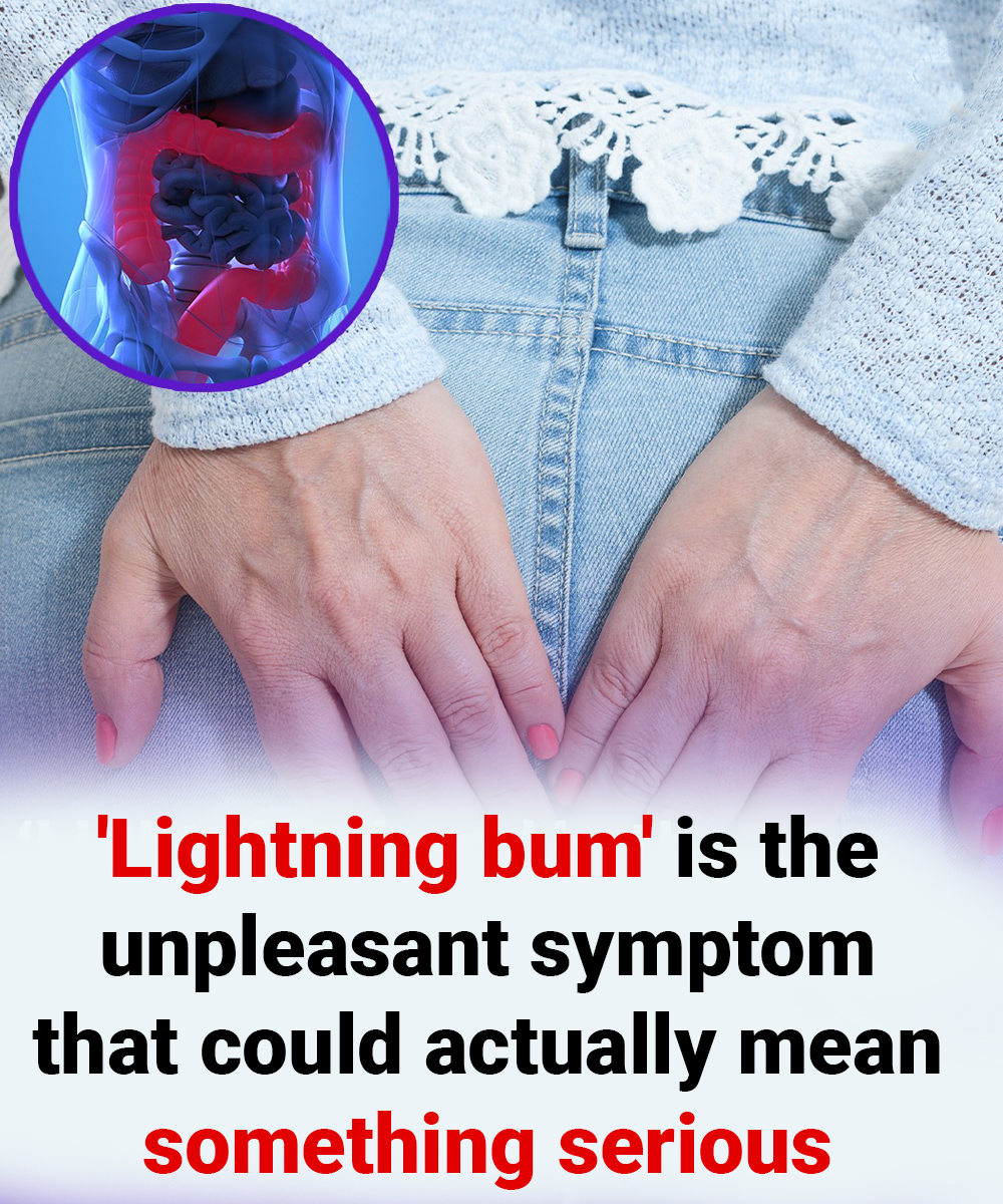 ‘Lightning bum’ is the unpleasant symptom that could actually mean something serious