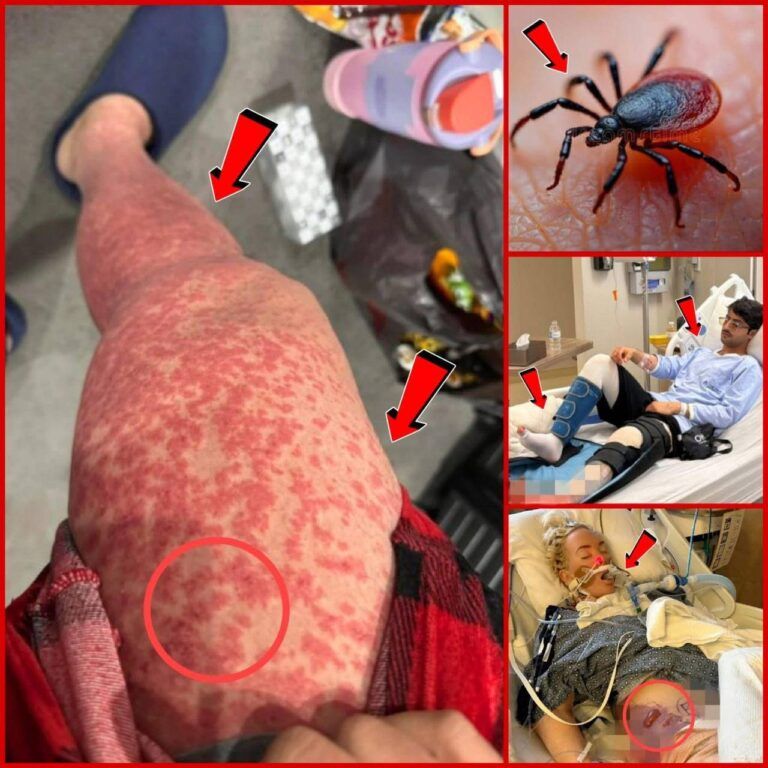 These are the consequences of sleeping with this one!