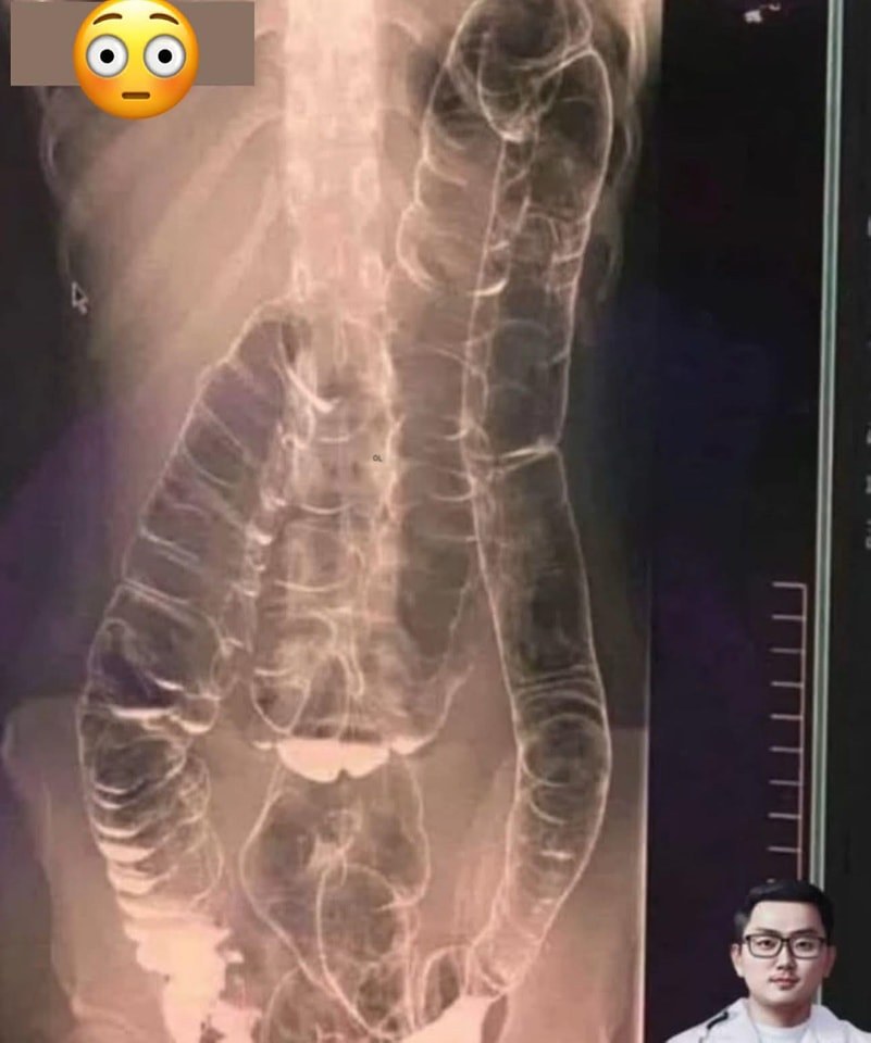 Your legs are screaming ‘HELP!:’ 5 warning signs from your liver