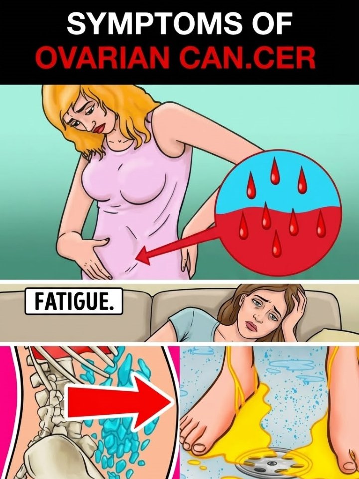 The Link Between Ovarian and Bre.ast Can.cer: What Every Woman Should Know