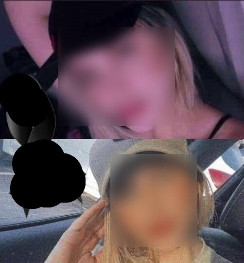 A 22-year-old girl d!es after undergoing plastic surgery and leaves…. See more